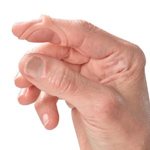 Férula Oval Dr's choice